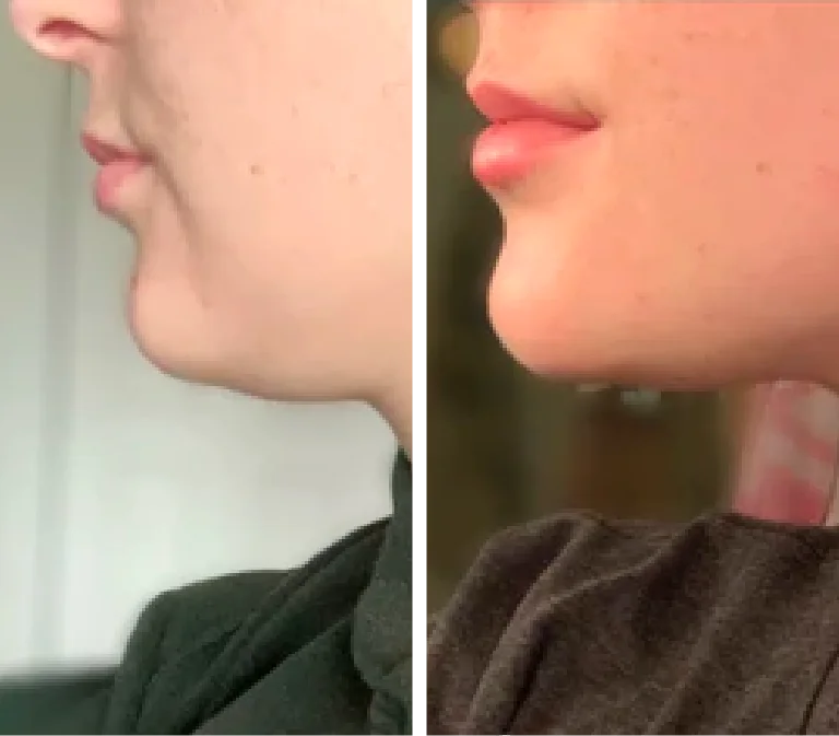 Masajeador Facial Y De Cuello