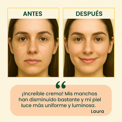 Despídete de las manchas, ¡y presume una piel luminosa y llena de vida!